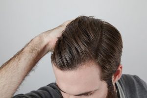 Understanding Hair Loss: Causes and Factors
